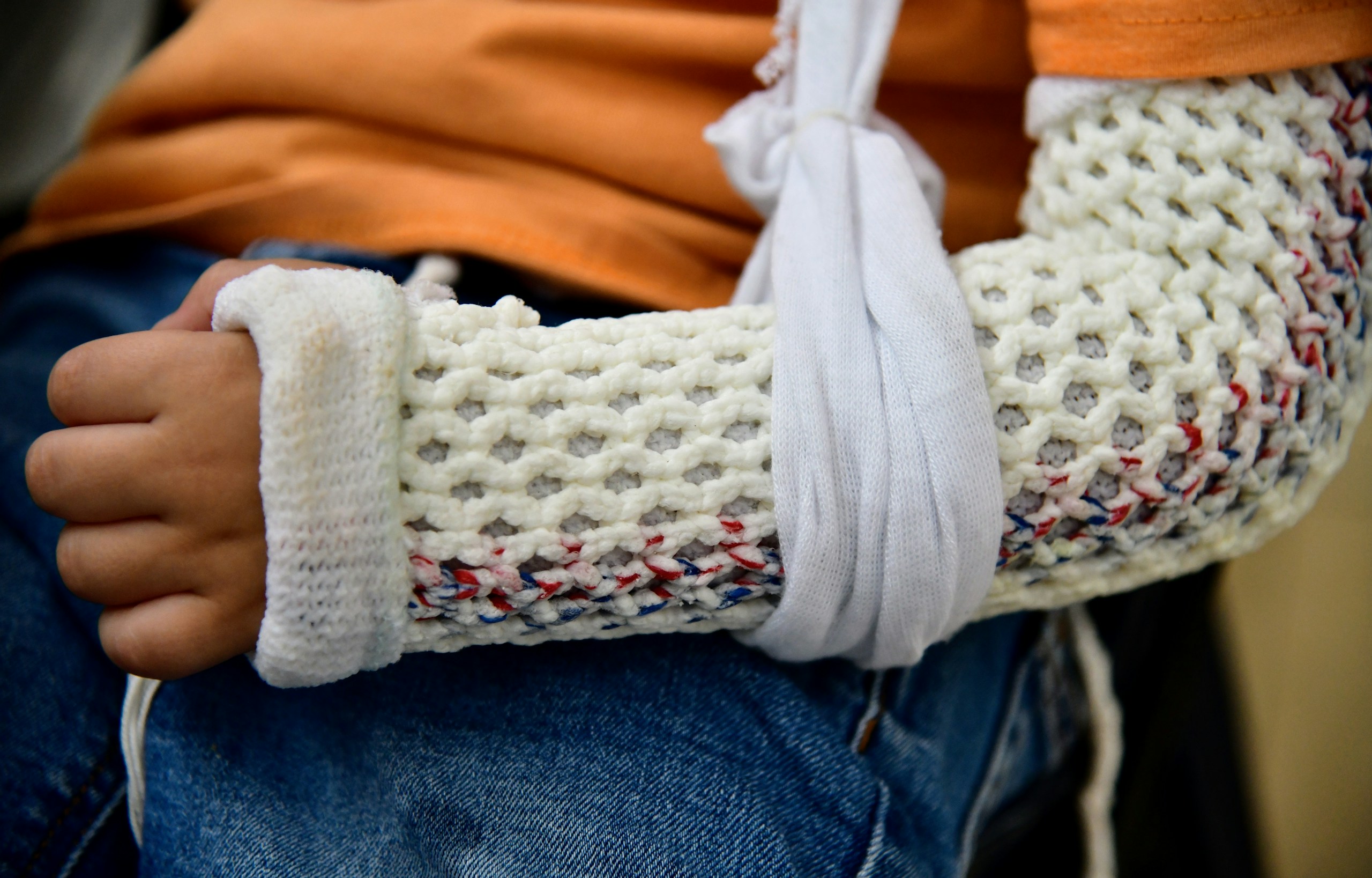 A small boy nearly four years old was playing at a playground and broke his wrist. Has a new cast on his arm with a sling.